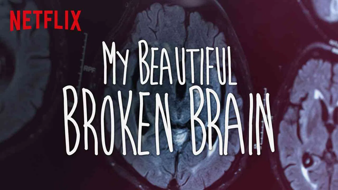 My Beautiful Broken Brain2016
