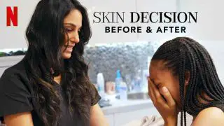 Skin Decision: Before and After 2020